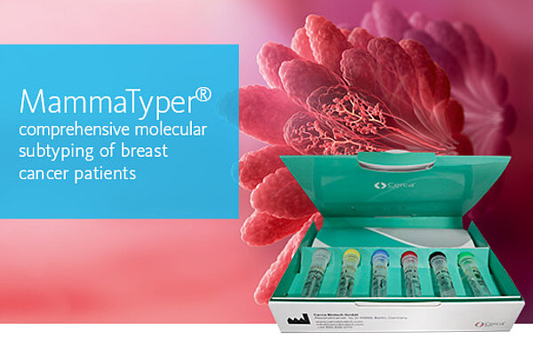 [Sysmex Egypt (english)] MammaTyper® comprehensive molecular subtyping of breast cancer patients